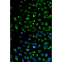 Interferon Alpha/Beta Receptor 2 (IFNAR2) Antibody