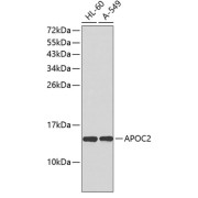 Western blot analysis of extracts of various cell lines using APOC2 Antibody.