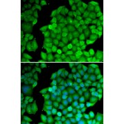 Immunofluorescence analysis of U2OS cells using Cyclin D2 Antibody