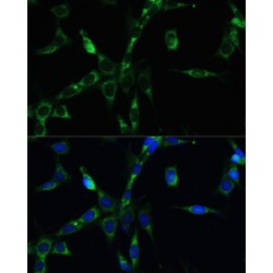 Mitotic Checkpoint Serine/Threonine-Protein Kinase BUB1 Beta (BUB1B) Antibody