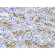 Immunohistochemistry of paraffin-embedded Rat kidney using GGT1 Antibody (1/100 dilution, 40x lens).