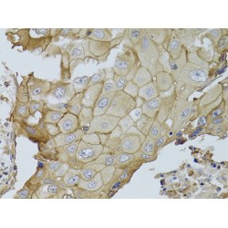 Glutathione Hydrolase 1 Proenzyme (GGT1) Antibody