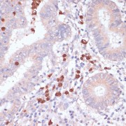 Immunohistochemistry of paraffin-embedded Human colon using CD82 Antibody (1/100 dilution, 40x lens).