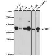 Western blot analysis of extracts of various cell lines using AKR1C3 Antibody (1/1000 dilution).