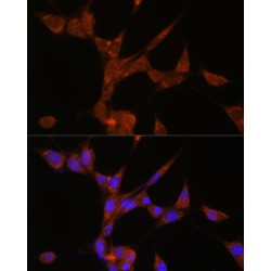 Aldo-Keto Reductase Family 1 Member C3 (AKR1C3) Antibody