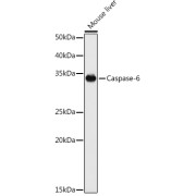 Western blot analysis of extracts of various cell lines using Caspase-6 Antibody (1/1000 dilution).