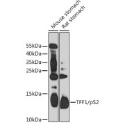 Western blot analysis of extracts of various cell lines using TFF1/pS2 Antibody (1/1000 dilution).