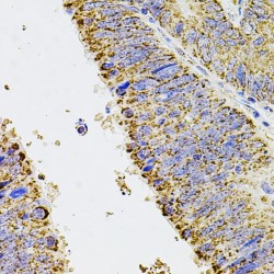 Retinal Dehydrogenase 1 (ALDH1A1) Antibody