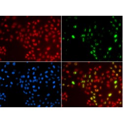 DNA Polymerase Eta (POLH) Antibody