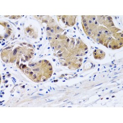 Prostacyclin Receptor (PTGIR) Antibody