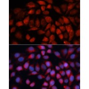 Immunofluorescence analysis of HeLa cells using ACADM Antibody (1/100 dilution, 40x lens). Blue: DAPI for nuclear staining.