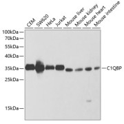 Western blot analysis of extracts of various cell lines using C1QBP Antibody (1/1000 dilution).