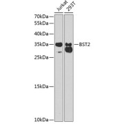 Western blot analysis of extracts of various cell lines using BST2 Antibody (1/1000 dilution).