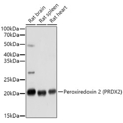 Peroxiredoxin 2 (PRDX2) Antibody