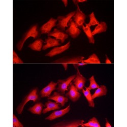 Peroxiredoxin 2 (PRDX2) Antibody