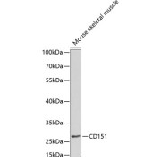 Western blot analysis of extracts of Mouse skeletal muscle using CD151 Antibody (1/1000 dilution).