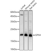 Western blot analysis of extracts of various cell lines using GPX4 Antibody (1/1000 dilution).