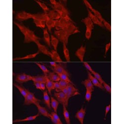 Glutathione Peroxidase 4 (GPX4) Antibody