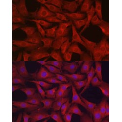 Glutathione Peroxidase 4 (GPX4) Antibody