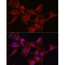 Glutathione Peroxidase 4 (GPX4) Antibody