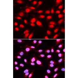 U2 Small Nuclear RNA Auxiliary Factor 2 (U2AF2) Antibody