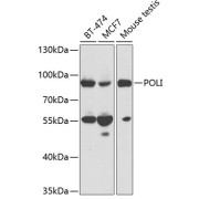 Western blot analysis of extracts of various cell lines using POLI Antibody (1/1000 dilution).