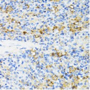 Immunohistochemistry of paraffin-embedded Rat spleen using CD27 Antibody (1/100 dilution, 40x lens).