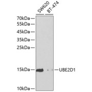 Western blot analysis of extracts of various cell lines using UBE2D1 Antibody (1/1000 dilution).