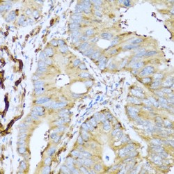 Placental Lactogen (CSH1) Antibody