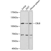 Western blot analysis of extracts of various cell lines using CBLB Antibody (1/1000 dilution).