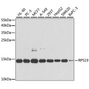 Western blot analysis of extracts of various cell lines using RPS19 Antibody (1/1000 dilution).