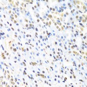 Immunohistochemistry of paraffin-embedded Rat kidney using RUNX1 Antibody (1/100 dilution, 40x lens).