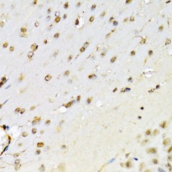 Runt Related Transcription Factor (RUNX1) Antibody