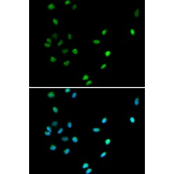 Runt Related Transcription Factor (RUNX1) Antibody