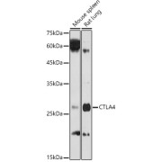 Western blot analysis of extracts of various cell lines using CD152/CTLA-4 Antibody (1/1000 dilution).