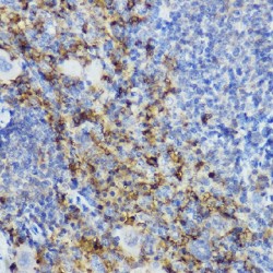 Cytotoxic T-Lymphocyte Associated Antigen 4 (CTLA4) Antibody