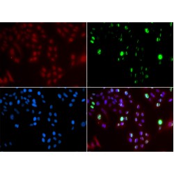 Fanconi Anemia Complementation Group D2 (FANCD2) Antibody