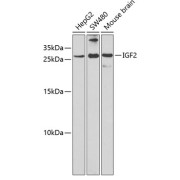 Western blot analysis of extracts of various cell lines using IGF2 Antibody (1/1000 dilution).