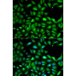 Insulin-Like Growth Factor II (IGF2) Antibody