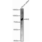 Western blot analysis of extracts of Mouse spleen using IKKβ Antibody (1/1000 dilution).