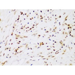 Inhibitor of Nuclear Factor Kappa-B Kinase Subunit Beta / IKKB (IKBKB) Antibody