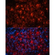 Immunofluorescence analysis of Rat kidney using LCN2 Antibody (1/100 dilution). Blue: DAPI for nuclear staining.