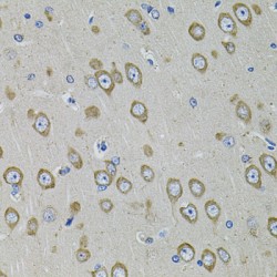 Calcium/calmodulin-Dependent 3',5'-Cyclic Nucleotide Phosphodiesterase 1B (PDE1B) Antibody