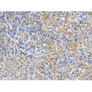 Immunohistochemistry of paraffin-embedded Rat spleen using PRKCE Antibody (1/200 dilution, 40x lens).