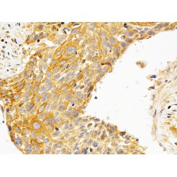 Protein Kinase C Epsilon (PRKCE) Antibody