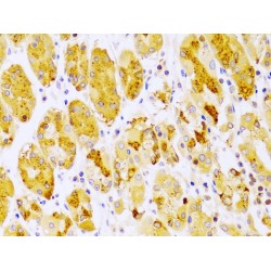 Protein Kinase C Epsilon (PRKCE) Antibody