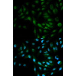 Mitogen-Activated Protein Kinase 7 / ERK5 (MAPK7) Antibody