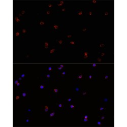 Receptor-Type Tyrosine-Protein Phosphatase C / CD45 (PTPRC) Antibody