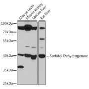 Western blot analysis of extracts of various cell lines using Sorbitol Dehydrogenase Antibody (1/500 dilution).