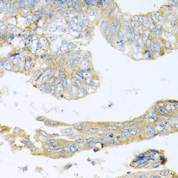 Histone Deacetylase 3 (HDAC3) Antibody